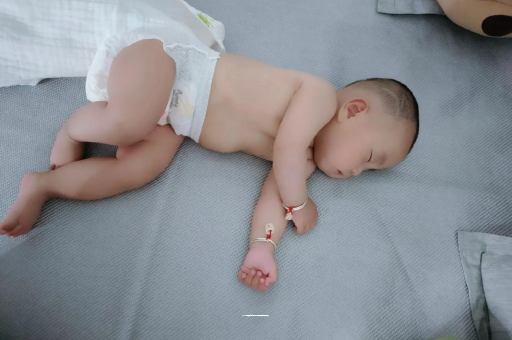 宁津六个月宝宝眼睛散光